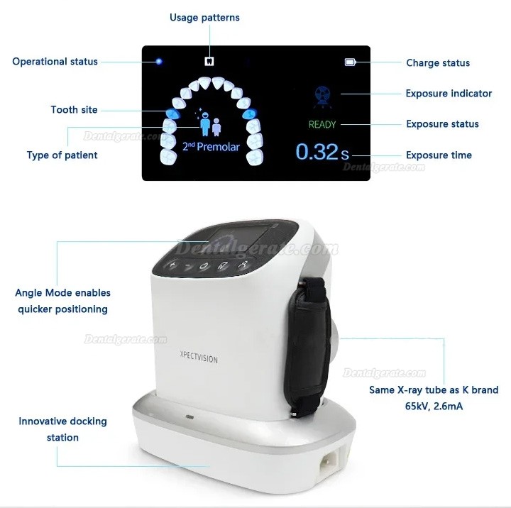 Handgehaltenes Dental R&ouml;ntgenger&auml;t, Mobile Hochfrequenz R&ouml;ntgenger&auml;t XVbeam2000